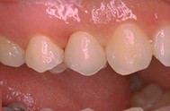 Ceram3b.jpg (13806 octets)