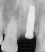 uni1_rx.jpg (13770 octets)